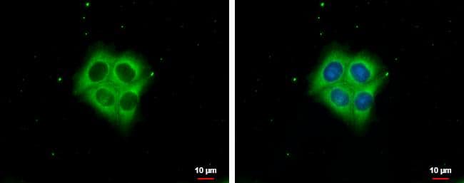 Ezrin antibody [N2C2], Internal detects Ezrin protein at cytoplasm by immunofluorescent analysis.Sample: HCT116 cells were fixed in ice-cold MeOH for 5 min.Green: Ezrin protein stained by Ezrin antibody [N2C2], Internal (NBP2-16396) diluted at 1:1000.Blue: Hoechst 33342 staining. 