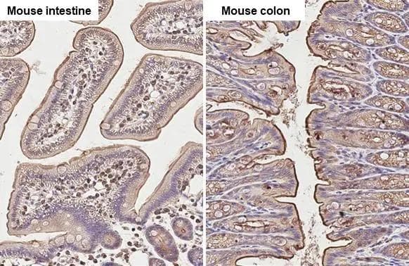 Ezrin antibody [N2C2], Internal detects Ezrin protein at cell membrane and cytoplasm by immunohistochemical analysis.Sample: Paraffin-embedded mouse tissue.Ezrin stained by Ezrin antibody [N2C2], Internal (NBP2-16396) diluted at 1:500.Antigen Retrieval: Citrate buffer, pH 6.0, 15 min 