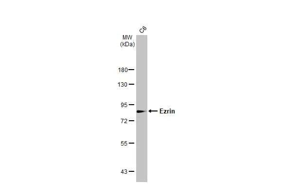 Whole cell extract (30 ug) was separated by 7.5% SDS-PAGE, and the membrane was blotted with Ezrin antibody [N2C2], Internal (NBP2-16396) diluted at 1:1000. The HRP-conjugated anti-rabbit IgG antibody  was used to detect the primary antibody. 