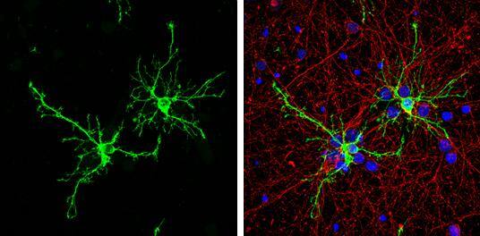 FABP7 antibody [N1C3] detects FABP7 protein by immunofluorescent analysis.Sample: DIV9 rat E18 primary hippocampal neuron and glia cells were fixed in 4% paraformaldehyde at RT for 15 min.Green: FABP7 stained by FABP7 antibody [N1C3] (NBP2-16399) diluted at 1:500.Red: beta Tubulin 3/ Tuj1, stained by beta Tubulin 3/ Tuj1 antibody [GT11710]  diluted at 1:500.Blue: Fluoroshield with DAPI . 