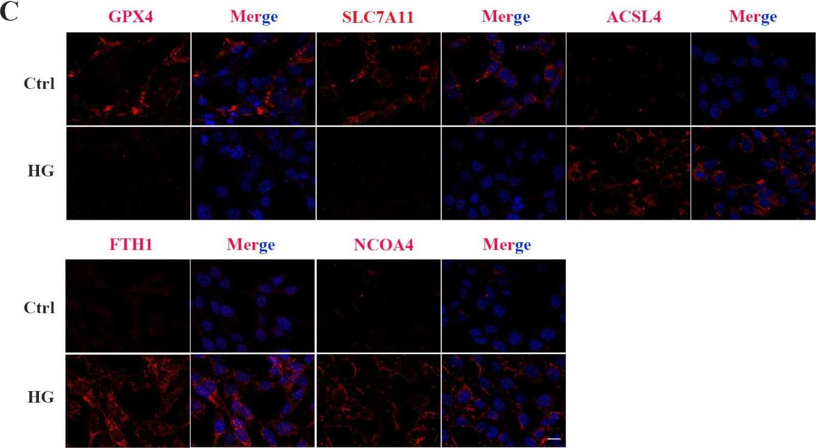 HG causes changes in the expression of ferroptosis-related proteins in 661W cells. (A) Western blot analysis of ferroptosis-related protein expression levels in HG-induced 661W cells. GAPDH was used as a control. (B) Expression of GPX4 and SLC7A11 proteins was significantly downregulated in HG-stimulated 661W cells after 12, 18, and 24 h. HG induced obvious upregulation in the expression of ACSL4, FTH1, and NCOA4 in 661W cells compared with the Ctrl group. (C) Immunofluorescence staining of localization of ferroptosis-related proteins (red) and nuclear (blue) in HG-induced 661W cells after 18 h. Data are shown as mean +/- SEM, n = 3 per group for Western blotting. p = not significant [ns], * p < 0.05, ** p < 0.01, *** p < 0.001 versus Ctrl group. Scale bar: 50 μm. Image collected and cropped by CiteAb from the following open publication (//www.mdpi.com/1422-0067/24/23/16946), licensed under a CC-BY license. Not internally tested by Novus Biologicals.