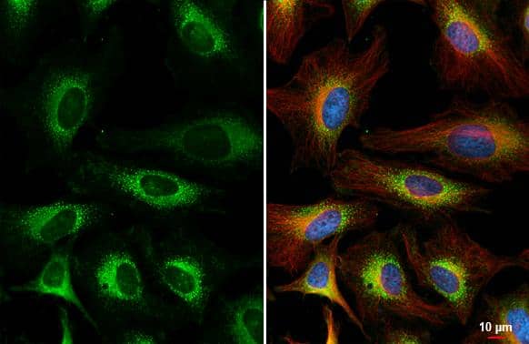 Immunocytochemistry/ Immunofluorescence FACL4 Antibody