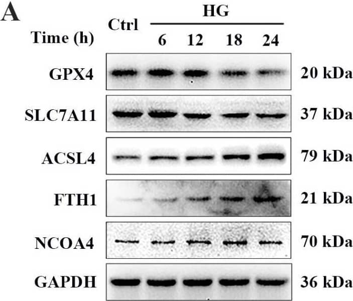 HG causes changes in the expression of ferroptosis-related proteins in 661W cells. (A) Western blot analysis of ferroptosis-related protein expression levels in HG-induced 661W cells. GAPDH was used as a control. (B) Expression of GPX4 and SLC7A11 proteins was significantly downregulated in HG-stimulated 661W cells after 12, 18, and 24 h. HG induced obvious upregulation in the expression of ACSL4, FTH1, and NCOA4 in 661W cells compared with the Ctrl group. (C) Immunofluorescence staining of localization of ferroptosis-related proteins (red) and nuclear (blue) in HG-induced 661W cells after 18 h. Data are shown as mean +/- SEM, n = 3 per group for Western blotting. p = not significant [ns], * p < 0.05, ** p < 0.01, *** p < 0.001 versus Ctrl group. Scale bar: 50 μm. Image collected and cropped by CiteAb from the following open publication (//www.mdpi.com/1422-0067/24/23/16946), licensed under a CC-BY license. Not internally tested by Novus Biologicals.