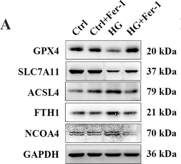 Fer-1 treatment attenuated changes in ferroptosis-related proteins’ expression in HG-stimulated 661W cells after 18 h. (A) Western blot analysis of ferroptosis-related proteins’ expression levels in HG-induced 661W cells after Fer-1 treatment. GAPDH was used as a control. (B) The downregulation in GPX4 and SLC7A11 protein expression in HG-stimulated 661W cells was significantly attenuated after Fer-1 treatment. The upregulation in ACSL4, FTH1, and NCOA4 protein expression in HG-stimulated 661W cells was effectively abrogated after Fer-1 treatment. (C) Immunofluorescence staining of ferroptosis-related proteins (red) and nuclear (blue) in HG-induced 661W cells after Fer-1 administration. Data are shown as mean +/- SEM, n = 3 per group for Western blotting. p = not significant [ns], * p < 0.05, ** p < 0.01 versus Ctrl group. Scale bar: 50 μm. Image collected and cropped by CiteAb from the following open publication (//www.mdpi.com/1422-0067/24/23/16946), licensed under a CC-BY license. Not internally tested by Novus Biologicals.