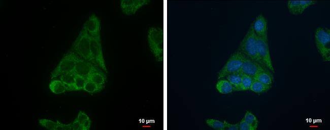 FADS1 antibody detects FADS1 protein at mitochondria by immunofluorescent analysis.Sample: Hep G2 cells were fixed in 2% paraformaldehyde/culture medium at 37oC for 30 min.Green: FADS1 protein stained by FADS1 antibody (NBP2-16407) diluted at 1:500.Blue: Hoechst 33342 staining.Scale bar = 10 um. 