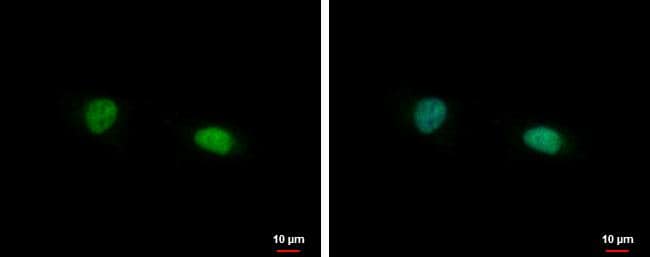 FAM98B antibody detects FAM98B protein at nucleus by immunofluorescent analysis.Sample: SKNSH cells were fixed in 4% paraformaldehyde at RT for 15 min.Green: FAM98B protein stained by FAM98B antibody (NBP2-16425) diluted at 1:500.Blue: Hoechst 33342 staining. 
