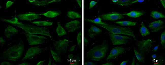 Fetuin B antibody detects Fetuin B protein at cytoplasm by immunofluorescent analysis.Sample: SK-N_SH cells were fixed in 4% paraformaldehyde at RT for 15 min.Green: Fetuin B protein stained by Fetuin B antibody (NBP2-16470) diluted at 1:500.Blue: Hoechst 33342 staining.Scale bar = 10 um. 