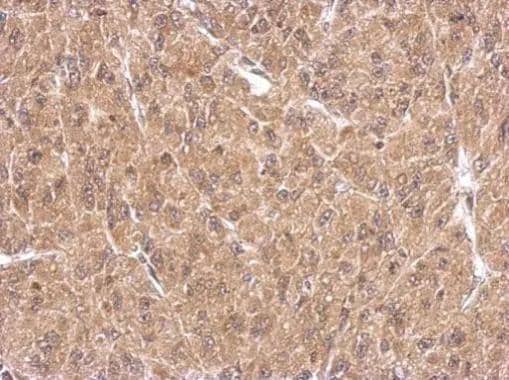 Immunohistochemical analysis of paraffin-embedded U87 xenograft, using FHL1(NBP2-16490) antibody at 1:500 dilution. br>Antigen Retrieval: Trilogy(TM) (EDTA based, pH 8.0) buffer, 15min 