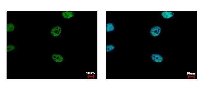 FLI1 antibody detects FLI1 protein at nucleus by immunofluorescent analysis. Sample: HeLa cells were fixed in 4% paraformaldehyde at RT for 15 min.Green: FLI1 protein stained by FLI1 antibody (NBP2-16500) diluted at 1:500.Blue: Hoechst 33343 staining. 