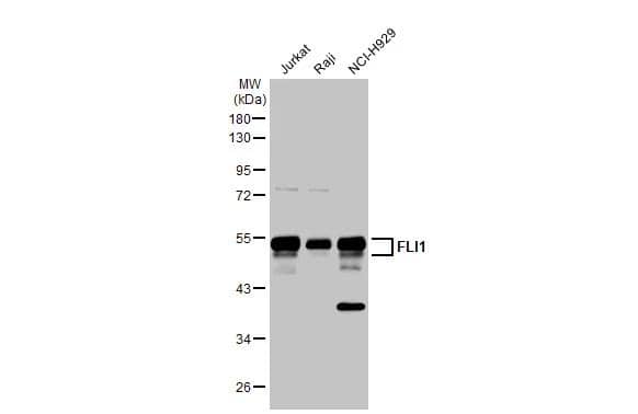 Various whole cell extracts (30 ug) were separated by 10% SDS-PAGE, and the membrane was blotted with FLI1 antibody (NBP2-16500) diluted at 1:1000. The HRP-conjugated anti-rabbit IgG antibody  was used to detect the primary antibody. 
