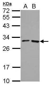 Sample (30 ug of whole cell lysate)  A: 293T  B: A431  12% SDS PAGE  NBP2-16514 diluted at 1:1000  