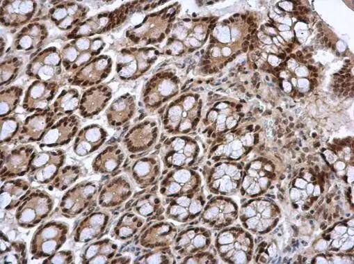 FOXI1 antibody [N2C3] detects FOXI1 protein at cytoplasm and nucleus in mouse colon by immunohistochemical analysis. Sample: Paraffin-embedded mouse colon. FOXI1 antibody [N2C3] (NBP2-16518) diluted at 1:500. br>Antigen Retrieval: Citrate buffer, pH 6.0, 15 min 