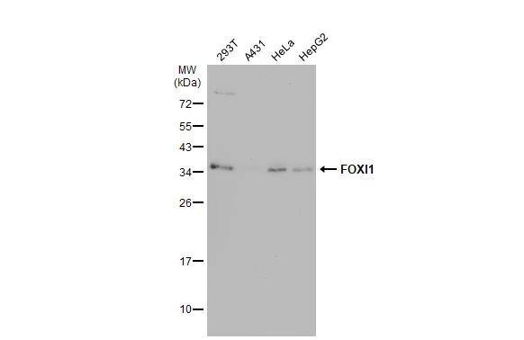 Various whole cell extracts (30 ug) were separated by 12% SDS-PAGE, and the membrane was blotted with FOXI1 antibody [N2C3] (NBP2-16518) diluted at 1:500. The HRP-conjugated anti-rabbit IgG antibody  was used to detect the primary antibody. 