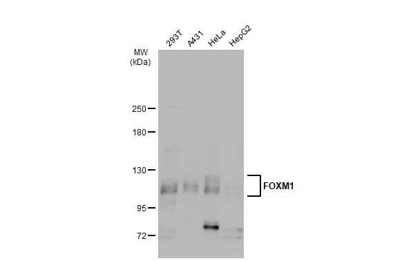 Various whole cell extracts (30 ug) were separated by 5% SDS-PAGE, and the membrane was blotted with FOXM1 antibody (NBP2-16519) diluted at 1:500. The HRP-conjugated anti-rabbit IgG antibody  was used to detect the primary antibody. 