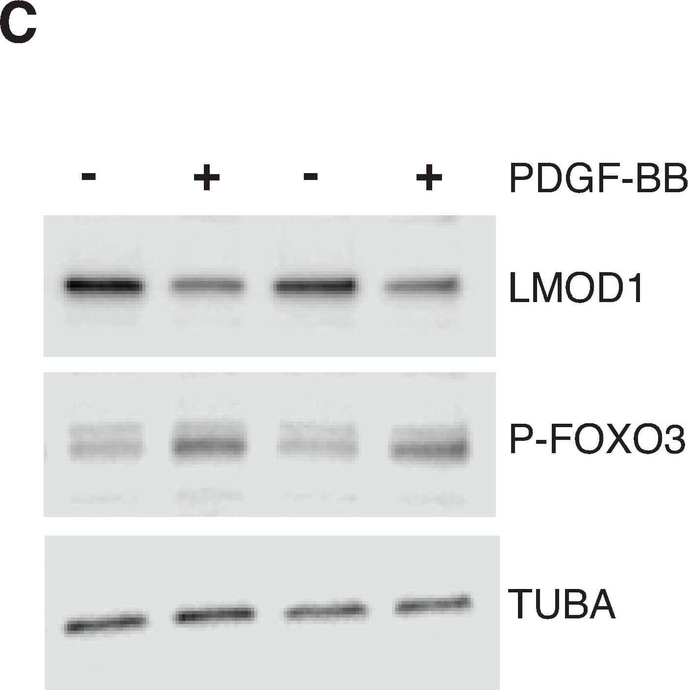 Western Blot: FOXO3 Antibody [NBP2-16521] - LMOD1 expression is mediated by PDGF-BB-FOXO3 signaling cascade.(A) UCSC Browser screenshot of the LMOD1 CAD locus at chromosome 1q32.1 highlighting the candidate causal variant, rs34091558, overlapping ATAC-seq open chromatin & RNA-seq tracks in HCASMCs treated with PDGF-BB (n = 2 biological replicates). Genomic coordinates refer to hg19 assembly. Quantitative RT-PCR (B) & Western blotting (C) data revealing PDGF-BB & phosphorylated-FOXO3 (P-FOXO3) mediated LMOD1 expression. (D) Co-expression microarray analysis performed in a cohort of carotid atherosclerotic plaques (n = 127) indicating that LMOD1 & FOXO3 are positively correlated in arterial tissues. Image collected & cropped by CiteAb from the following publication (//pubmed.ncbi.nlm.nih.gov/30444878), licensed under a CC-BY license. Not internally tested by Novus Biologicals.