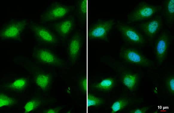 FOXO3A antibody [C3], C-term detects FOXO3A protein at nucleus by immunofluorescent analysis.Sample: HeLa cells were fixed in 4% paraformaldehyde at RT for 15 min.Green: FOXO3A stained by FOXO3A antibody [C3], C-term (NBP2-16521) diluted at 1:1000.Blue: Hoechst 33342 staining.Scale bar= 10 um. 