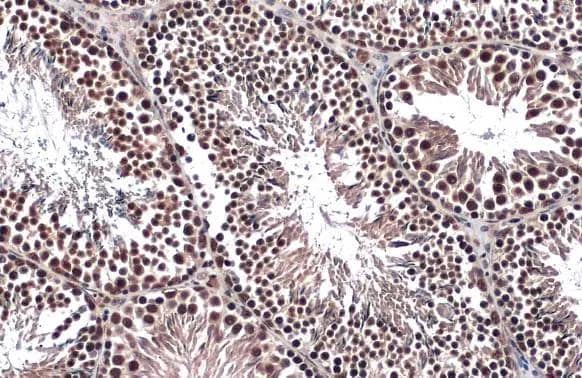 FOXO3A antibody [C3], C-term detects FOXO3A protein at nucleus by immunohistochemical analysis.Sample: Paraffin-embedded mouse testis.FOXO3A stained by FOXO3A antibody [C3], C-term (NBP2-16521) diluted at 1:500.Antigen Retrieval: Citrate buffer, pH 6.0, 15 min 
