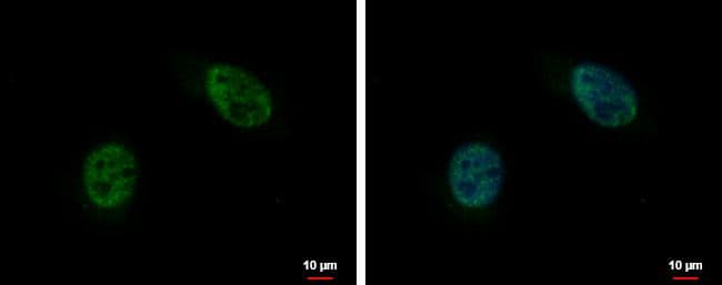 C10orf4 antibody detects C10orf4 protein at nucleus by immunofluorescent analysis.Sample: HeLa cells were fixed in 4% paraformaldehyde at RT for 15 min.Green: C10orf4 protein stained by C10orf4 antibody (NBP2-16528) diluted at 1:500.Blue: Hoechst 33342 staining.Scale bar = 10 um. 