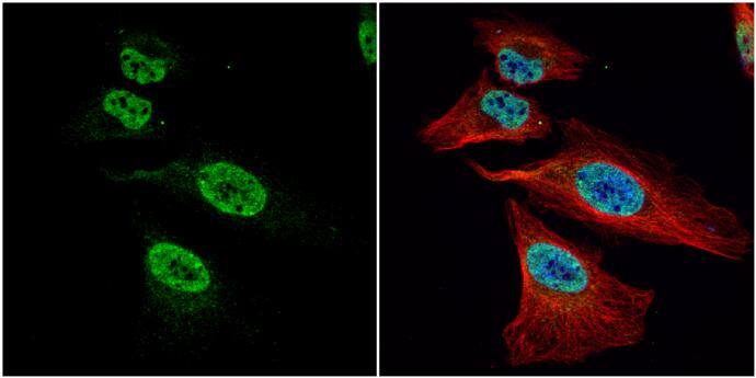 FUBP1 antibody detects FUBP1 protein at nucleus by immunofluorescent analysis.Sample: HeLa cells were fixed in 4% paraformaldehyde at RT for 15 min.Green: FUBP1 protein stained by FUBP1 antibody (NBP2-16543) diluted at 1:1000.Red: alpha Tubulin, a cytoskeleton marker, stained by alpha Tubulin antibody [B-5-1-2]  diluted at 1:10000.Blue: Hoechst 33342 staining. 