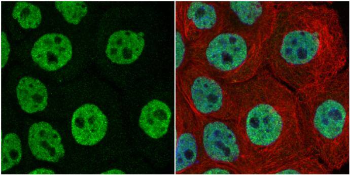 FUBP1 antibody detects FUBP1 protein at nucleus by immunofluorescent analysis.Sample: A431 cells were fixed in 4% paraformaldehyde at RT for 15 min.Green: FUBP1 protein stained by FUBP1 antibody (NBP2-16543) diluted at 1:1000.Red: alpha Tubulin, a cytoskeleton marker, stained by alpha Tubulin antibody [GT114]  diluted at 1:1000.Blue: Hoechst 33342 staining. 