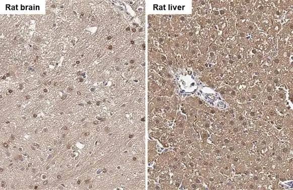 FAH antibody detects FAH protein by immunohistochemical analysis.Sample: Paraffin-embedded rat tissues.FAH stained by FAH antibody (NBP2-16546) diluted at 1:500.Antigen Retrieval: Citrate buffer, pH 6.0, 15 min 