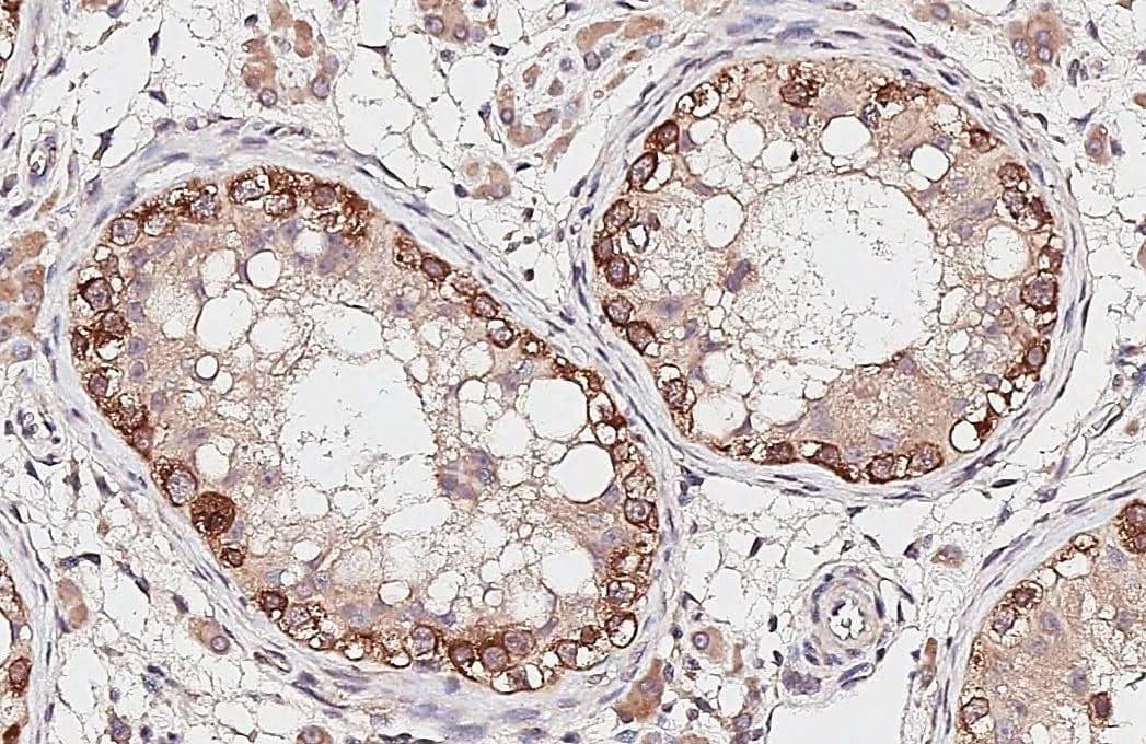 G3BP1 antibody detects G3BP1 protein by immunohistochemical analysis.Sample: Paraffin-embedded human testis.G3BP1 stained by G3BP1 antibody (NBP2-16563) diluted at 1:250.Antigen Retrieval: Tris-EDTA buffer, pH 9.0, 15 min 