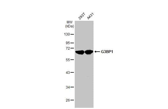Various whole cell extracts (30 ug) were separated by 10% SDS-PAGE, and the membrane was blotted with G3BP1 antibody (NBP2-16563) diluted at 1:5000. The HRP-conjugated anti-rabbit IgG antibody  was used to detect the primary antibody. 