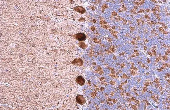 GABA A Receptor alpha 5 antibody [N2C2], Internal detects GABA A Receptor alpha 5 protein at cytoplasm by immunohistochemical analysis.Sample: Paraffin-embedded mouse cerebellum.GABA A Receptor alpha 5 stained by GABA A Receptor alpha 5 antibody [N2C2], Internal (NBP2-16567) diluted at 1:500.Antigen Retrieval: Citrate buffer, pH 6.0, 15 min 