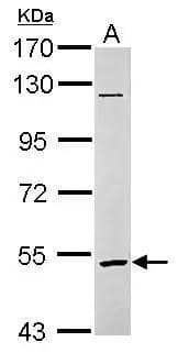 Western Blot GABA-A R rho 2 Antibody