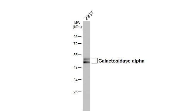 Whole cell extract (30 ug) was separated by 10% SDS-PAGE, and the membrane was blotted with Galactosidase alpha antibody [N1C2] (NBP2-16576) diluted at 1:1000. The HRP-conjugated anti-rabbit IgG antibody  was used to detect the primary antibody. 