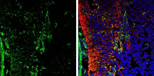 Galectin 1 antibody detects Galectin 1 protein expression by immunohistochemical analysis.Sample: Frozen sectioned E13.5 Rat brain. Green: Galectin 1 protein stained by Galectin 1 antibody (NBP2-16580) diluted at 1:250.Red: beta Tubulin 3/ TUJ1, a mature neuron marker, stained by beta Tubulin 3/ TUJ1 antibody [GT11710]  diluted at 1:500.Blue: Fluoroshield with DAPI . 