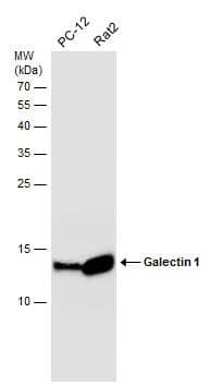 Various whole cell extracts (30 ug) were separated by 15% SDS-PAGE, and the membrane was blotted with Galectin 1 antibody (NBP2-16580) diluted at 1:10000. The HRP-conjugated anti-rabbit IgG antibody  was used to detect the primary antibody. 