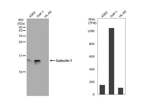 Various whole cell extracts (30 ug) were separated by 15% SDS-PAGE, and the membrane was blotted with Galectin 1 antibody (NBP2-16580) diluted at 1:2000. The HRP-conjugated anti-rabbit IgG antibody  was used to detect the primary antibody. Corresponding RNA expression data for the same cell lines are based on Human Protein Atlas program. 