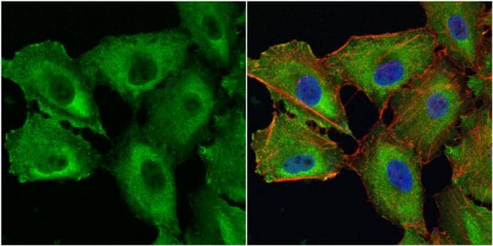 Galectin 1 antibody detects Galectin 1 protein at cytoplasm by immunofluorescent analysis.Sample: A549 cells were fixed in 4% paraformaldehyde at RT for 15 min.Green: Galectin 1 protein stained by Galectin 1 antibody (NBP2-16581) diluted at 1:500.Red: phalloidin, a cytoskeleton marker, stained by phalloidin (invitrogen, A12380) diluted at 1:200.Blue: Hoechst 33342 staining. 