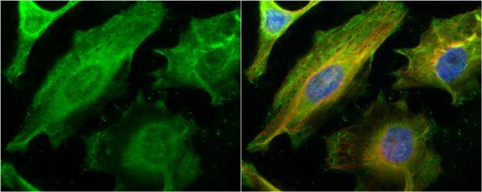 Galectin 1 antibody detects Galectin 1 protein at cytoplasm and nucleus by immunofluorescent analysis.Sample: HeLa cells were fixed in 4% paraformaldehyde at RT for 15 min.Green: Galectin 1 protein stained by Galectin 1 antibody (NBP2-16581) diluted at 1:200.Red: phalloidin, a cytoskeleton marker, stained by phalloidin (invitrogen, A12380) diluted at 1:200.Blue: Hoechst 33342 staining. 