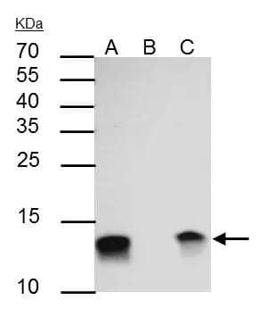 Galectin 1 antibody immunoprecipitates Galectin 1 protein in IP experiments. IP Sample: HeLa whole cell lysate/extract A : 30 ug whole cell lysate/extract of Galectin 1 antibody expressing HeLa cells B : Control with 2.5 ug of pre-immune rabbit IgG C : Immunoprecipitation of Galectin 1 by 2.5 ug of Galectin 1 antibody (NBP2-16581) 15% SDS-PAGE The immunoprecipitated Galectin 1 protein was detected by Galectin 1 antibody (NBP2-16581) diluted at 1 : 1000. EasyBlot anti-rabbit IgG (HRP)  was used as a secondary reagent. 