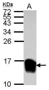 Sample (30 ug of whole cell lysate) A: NCI-H929 15% SDS PAGE NBP2-16581 diluted at 1:10000 The HRP-conjugated anti-rabbit IgG antibody  was used to detect the primary antibody. 