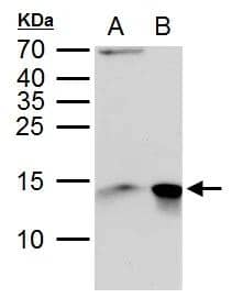 Galectin 1 antibody detects Galectin 1 protein by western blot analysis.A. 30 ug PC-12 whole cell lysate/extract B. 30 ug Rat2 whole cell lysate/extract15% SDS-PAGEGalectin 1 antibody (NBP2-16581) dilution: 1:10000 The HRP-conjugated anti-rabbit IgG antibody  was used to detect the primary antibody. 