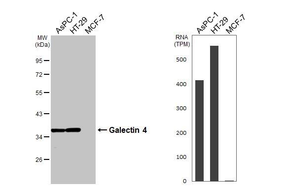 Various whole cell extracts (30 ug) were separated by 10% SDS-PAGE, and the membrane was blotted with Galectin 4 antibody (NBP2-16583) diluted at 1:1000. The HRP-conjugated anti-rabbit IgG antibody  was used to detect the primary antibody. Corresponding RNA expression data for the same cell lines are based on Human Protein Atlas program. 