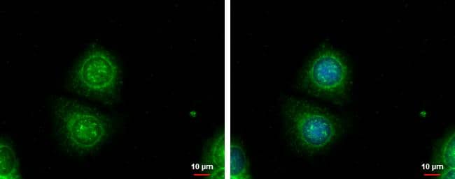 Galectin3 antibody detects Galectin3 protein at cytoplasm by immunofluorescent analysis.Sample: MCF-7 cells were fixed in ice-cold MeOH for 5 min.Green: Galectin3 protein stained by Galectin3 antibody (NBP2-16589) diluted at 1:1000.Blue: Hoechst 33342 staining.Scale bar = 10 um. 