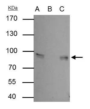 Gamma Catenin antibody immunoprecipitates Gamma Catenin protein in IP experiments. IP Sample: A431 whole cell lysate/extract A : 30 ug whole cell lysate/extract of Gamma Catenin protein expressing A431 cells B : Control with 2.5 ug of pre-immune rabbit IgG C : Immunoprecipitation of Gamma Catenin by 2.5 ug of Gamma Catenin antibody (NBP2-16600) 7.5% SDS-PAGE The immunoprecipitated Gamma Catenin protein was detected by Gamma Catenin antibody (NBP2-16600) diluted at 1 : 1000. EasyBlot anti-rabbit IgG (HRP)  was used as a secondary reagent. 