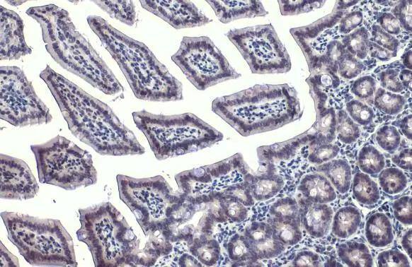 Immunohistochemistry-Paraffin GATA-4 Antibody