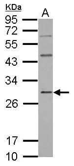 Sample (30 ug of whole cell lysate)  A: H1299  12% SDS PAGE  NBP2-16618 diluted at 1:500  