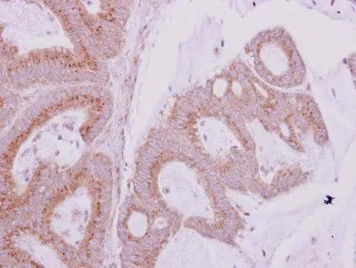 Immunohistochemistry GBF1 Antibody
