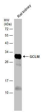 Rat tissue extract (50 ug) was separated by 12% SDS-PAGE, and the membrane was blotted with GCLM antibody (NBP2-16624) diluted at 1:5000. The HRP-conjugated anti-rabbit IgG antibody  was used to detect the primary antibody. 