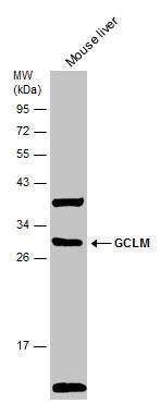 Mouse tissue extract (50 ug) was separated by 12% SDS-PAGE, and the membrane was blotted with GCLM antibody (NBP2-16624) diluted at 1:2000. The HRP-conjugated anti-rabbit IgG antibody  was used to detect the primary antibody. 