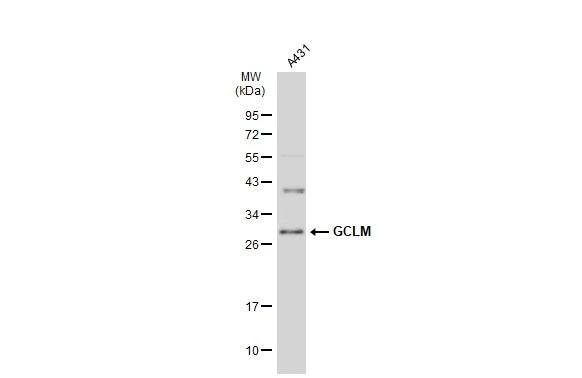 Whole cell extract (30 ug) was separated by 12% SDS-PAGE, and the membrane was blotted with GCLM antibody (NBP2-16624) diluted at 1:1000. The HRP-conjugated anti-rabbit IgG antibody  was used to detect the primary antibody. 