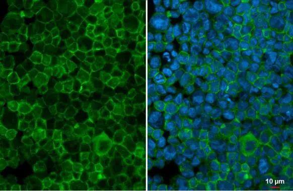 GCSF Receptor antibody [N2C1], Internal detects GCSF Receptor protein at cell membrane by immunofluorescent analysis.Sample: THP-1 cells were fixed in 4% paraformaldehyde at RT for 15 min.Green: GCSF Receptor stained by GCSF Receptor antibody [N2C1], Internal (NBP2-16629) diluted at 1:500.Blue: Fluoroshield with DAPI . 