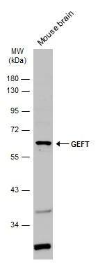 Mouse tissue extract (50 ug) was separated by 10% SDS-PAGE, and the membrane was blotted with GEFT antibody (NBP2-16636) diluted at 1:1000. The HRP-conjugated anti-rabbit IgG antibody  was used to detect the primary antibody. 