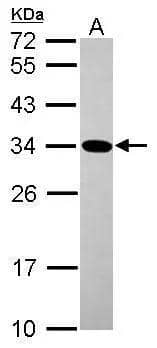 Sample (30 ug of whole cell lysate)  A: HCT116  12% SDS PAGE  NBP2-16639 diluted at 1:1000  